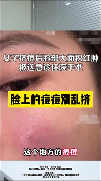 激素的作用和功效及副作用 4f7f03fbe9bd48898e4972661f2b0e4d_1692856602~tplv-dy-resize-origshort-autoq-75:330.jpeg?biz_tag=pcweb_cover&from=3213915784&s=PackSourceEnum_AWEME_DETAIL&sc=cover&se=false&x-expires=2008328400&x-signature=xpocXi4po1Jm94%2FOh9nPxrZNG5E%3D