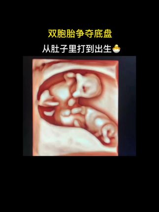 鲨鱼裤为啥不保暖 e74df062e54e404e8f7563917b101feb~tplv-dy-cropcenter:323:430.jpeg?biz_tag=pcweb_cover&from=3213915784&s=PackSourceEnum_PUBLISH&sc=cover&se=true&sh=323_430&x-expires=1985821200&x-signature=f1sqhg08uBOtcdmsXxLJxyjdYT8%3D