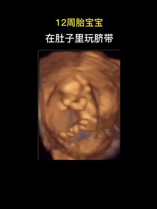 鲨鱼裤为啥不保暖 ocjFIqEAAnDwmgRJ6uUBbefM2ANnwQjG9VtaMB~tplv-dy-cropcenter:323:430.jpeg?biz_tag=pcweb_cover&from=3213915784&s=PackSourceEnum_PUBLISH&sc=cover&se=true&sh=323_430&x-expires=1988262000&x-signature=FZtQa%2FpO2xliJjiw4cJVQb2NseQ%3D