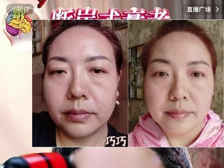 外在的紧致气色,根源在于内在状态。每日跟着直播间坚持敲敲头,唤醒神经活力,平衡身心,底子养稳固,面部不容易松弛暗沉,调颅焕颜术,由内调养,收获长久年轻态!#调颅焕颜术 #徒手变美 #全脸紧致 #健康美