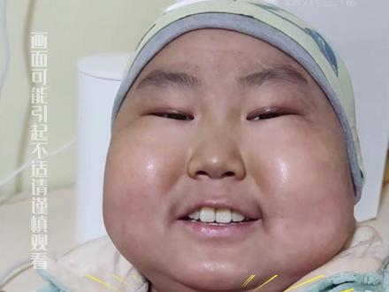 明明是“抗癌小王子”,为何贵州10岁男孩豪豪突然去世?那句“王子请恢复健康”再也听不到了#10岁白血病男孩豪豪离世 #豪豪 #网红 #影娱热点团 #内容启发搜索