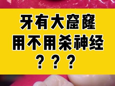 牙坏出了大洞,要咋办呢? #牙齿 #口腔健康 #硬核健康科普行动