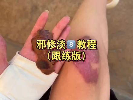 邪修#淡疤 教程(跟练版)#祛疤#好物推荐🔥 #杜伦疤痕凝胶