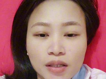 剖腹产报销完花费不算多,比顺产贵一千多#剖腹产 #产后宝妈 #剖腹产花费 #农村合作医疗 #顺产