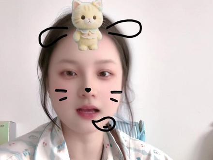 埋线的一丝丝建议#中医 #中医埋线 #中医埋线减肥