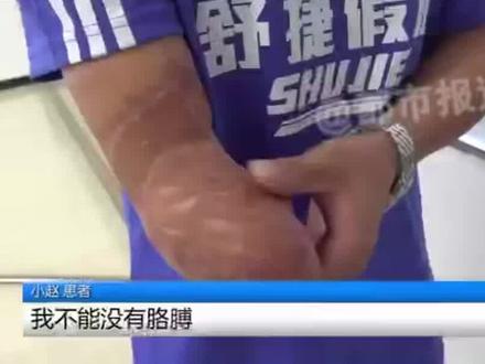 23岁小伙因意外失去右手,这项免费#黑科技 让他重获新生,“右手感觉就像回来了一样!”#河南dou知道
