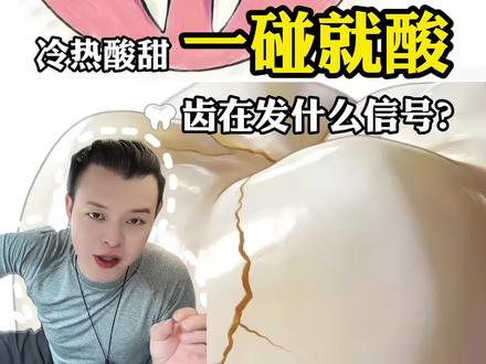冷热酸甜,一碰就酸,牙齿在发什么信号 #真实生活分享计划 #牙酸 #口腔科普 #汕尾