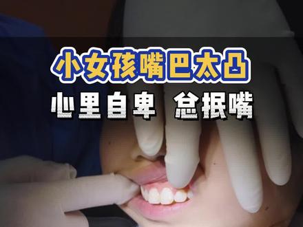 小女孩嘴巴太凸,心里自卑,总抿嘴#口腔科普