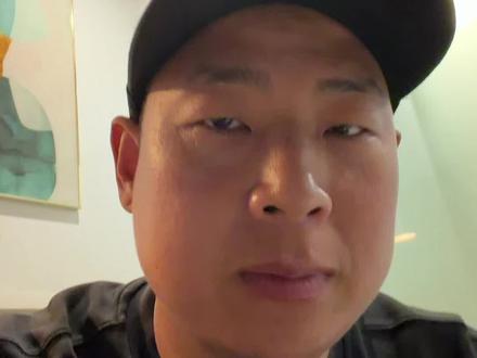 冬冬谈老乡拔牙竟然把舌神经给撕烂了几个月还没给结果我们普通人该注意什么。@拔牙被完全撕断舌神经 #口腔 #牙齿 #这是个真实的事情