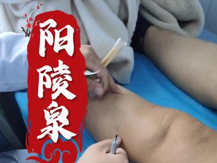 阳陵泉透刺阴陵泉!#阳陵泉#膝关节疼痛