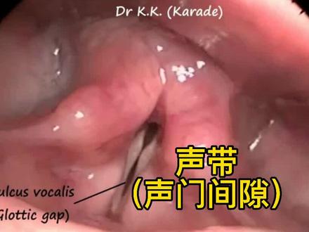 看看声带是如何闭合的#声乐教学#学唱歌#干货分享 #美声#艺考@DOU+小助手 @抖音小助手