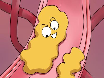 动脉粥样硬化#轻漫计划 #充能计划 #动画