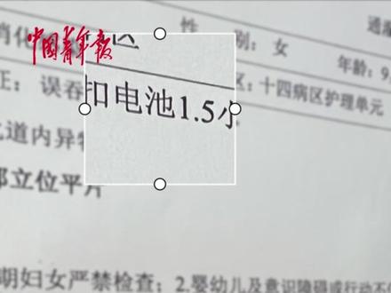小孩误吞纽扣电池,多次催吐无果,第三天排出时电池已被腐蚀发黑。