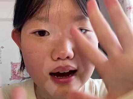 我也很开心置顶的第三个作品播放量破了百万以及粉丝也在不断的往上涨感谢每一个陪我的粉丝蓉蓉一定会好好录视频的!#白癜风@抖音热点 @抖音作者助手