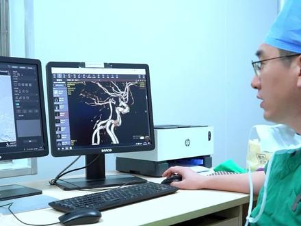 脑动脉瘤先别急着手术,脑血管造影(DSA)评估很重要#广东省第二人民医院 #神经外科 #脑血管造影