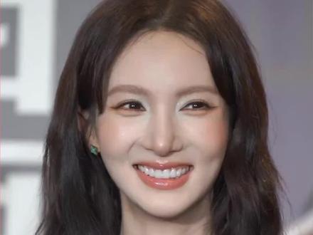 金晨怎么变成这样了#金晨 #医美