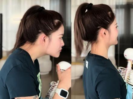 🔥全网最火的改善头前伸动作#头前倾