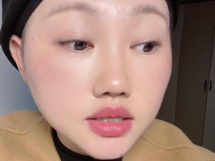 门特如何办理,一篇教会你#门特 #癌症 #抗ca日记