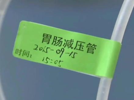 今天学习胃肠减压技术~ #护理 #实操