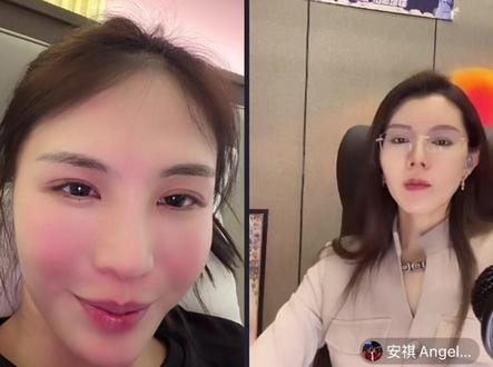 互相心疼@安祺Angel🌈 @中森明菜-ZH🌈