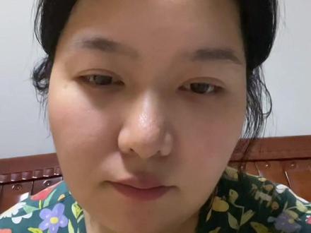 不要拔牙
#拔牙#拔牙后遗症