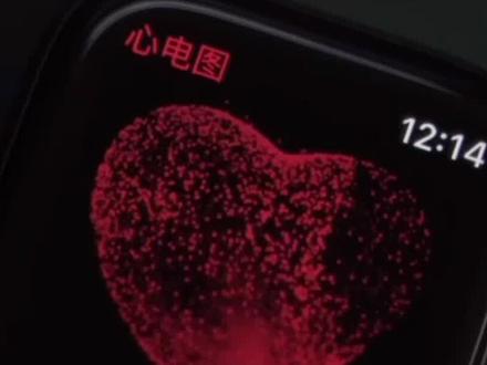 30秒教你解锁#applewatch 心电图功能