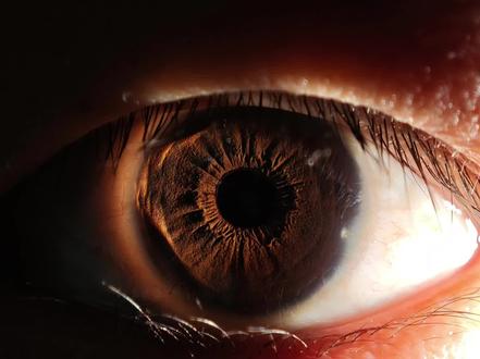 手机如何拍出清晰的瞳孔实况#小米15Ultra#小米实况 #手机摄影 #微距 #瞳孔