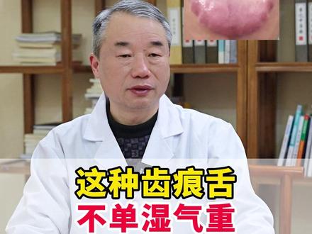 这种齿痕舌,不单是湿气重,已经三焦堵死,五脏全虚,健脾祛湿远 #中医内科 #中医科普 #中医庞海江