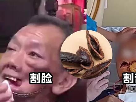恶魔果实槟榔,让人烂脸割舌死亡,为什么6000万人还在吃? #槟榔的危害 #万恶之源 #槟榔