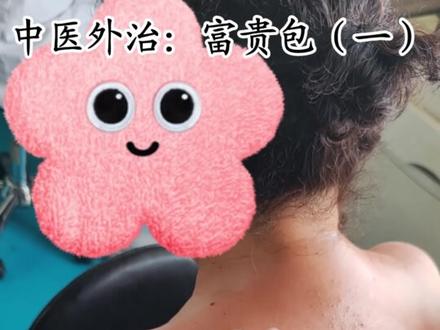 中医外治:富贵包(一)