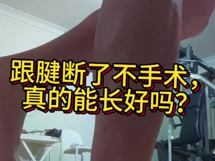 跟腱断了不做手术,真的能自己长好吗?用大白话讲清楚自愈原理,对比手术和保守治疗的区别,结合我17周真实康复经历,全是干货不绕弯子。
#跟腱断裂
#跟腱康复
#运动损伤
#保守治疗
#运动康复
