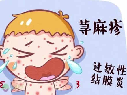 28.特异性体质和平时说的过敏性体质有区别吗