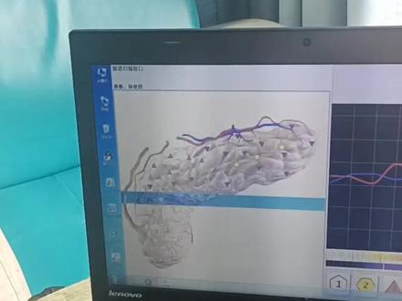 中国航天宇航员专用ERA细胞断层检测仪,检测项目最全,准确率最高,能够实现健康风险评估的检测仪器
一,人全九大系统检测
二,261个器官检测项目
三,四千种疾病风险评估
四,疾病早期筛查
五,预测未来3~5年的健康发展趋势 。