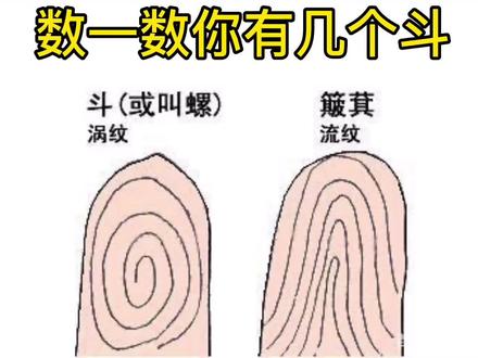 数数你的手上有几个斗和簸箕?长这么大才知道原来还与遗传有关啊!#遗传基因 #你有几个簸箕几个斗