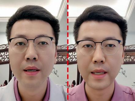 年纪轻轻满头白发,记住2个实用办法 #抖出健康知识宝藏