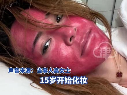 37岁女子自曝长期化妆不卸妆 皮肤红成“关公脸”过敏严重!“ 15岁开始化妆 晚上不卸妆长达22年 现在皮肤又痒又红 非常自卑 不敢见人#皮肤问题 #社会百态 #卸妆 #红肿