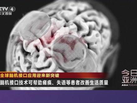 全球脑机接口应用迎来新突破