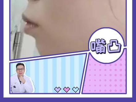 关于嘴凸的自测方法#凸嘴 #正颌