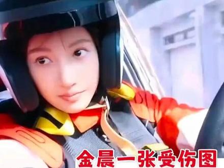 金晨一张受伤图,就是最好的公关文案 #金晨 #金晨道歉 #热点 #明星#跟着金沙摇摆一下