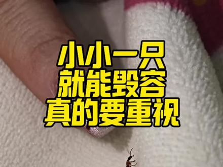 隐翅虫影子虫 隐翅虫,各地新闻网频频播报。
真的要重视!
小小一只就能毁容,堪称行走强酸。
不咬人、不蛰人,但万万不能上手拍打。
体内自带强腐蚀毒液,一旦沾染皮肤,
灼烧刺痛、红肿起泡、皮肤溃烂,就算愈合,也会留下顽固疤痕。
昼伏夜出,顺着灯光悄悄钻进室内,
墙角、窗台、绿植周边,全是它们的藏身据点。
夏秋季节大范围泛滥,体型细小隐蔽,完全防不胜防。
家里有老人小孩的,一定要多加提防,提前消杀才是关键。
这款隐翅虫专用杀虫剂,专门针对虫害习性,
日常喷洒在门窗缝隙、阳台死角、家里阴暗角落,
稳稳阻断虫子入户滋生。
药剂无色无味,温和安全,有娃有宠的家庭都能放心用。#隐翅虫的危害 #隐翅虫专用杀虫剂 #隐翅虫怎么预防消杀 #隐翅虫真的好可怕 #影子虫