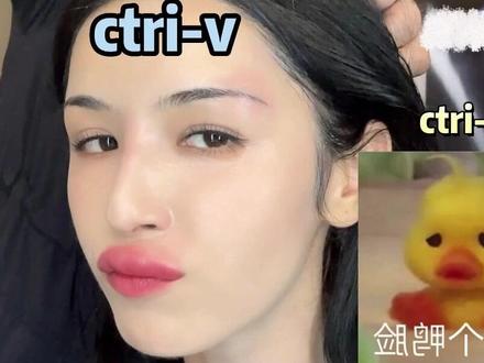 #哈妮克孜被蚊子咬成了香肠嘴,哈哈哈,快和我说这是哪里的蚊子,我好躲一下