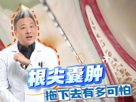 根尖囊肿到底是咋回事儿?咋处理好呢? #根尖囊肿 #抖出健康知识宝藏 #我的年度健康盘点 #口腔健康