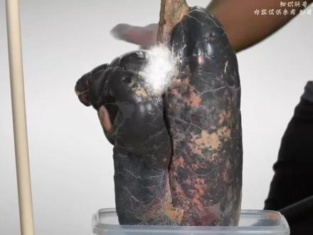 吸烟的危害#科普 #科普一下