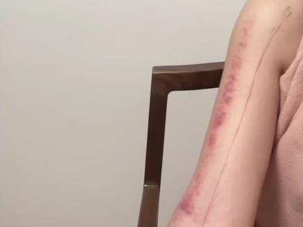 不高兴郁闷就找它。
心包经刮痧#古法健身 #穴位