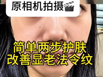 关于法令纹说说我的经验,详细记录如下 #法令纹#法令纹消失器#普通人变美思路#垮脸逆袭