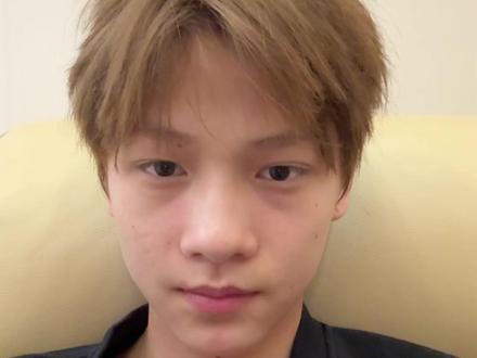 因为朋友一句我鼻子太大了,于是我。。。 #缩鼻翼 #鼻子 #颜值 #王辉