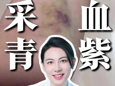 这真不能怪扎针的护士 #打针 #抽血#抖出健康知识宝藏