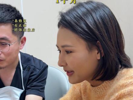 微起伏1个多月 #成都周顺波 #微起伏 #妈生鼻 #硅胶隆鼻 #云贵川渝