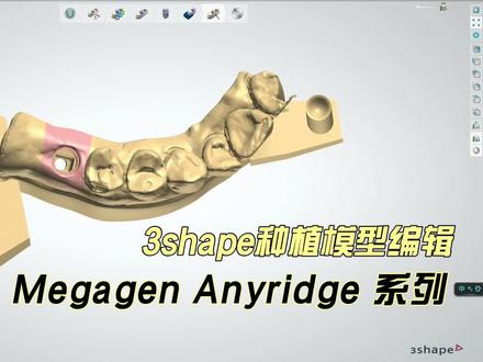 种植模型编辑.mp4 #3D模型 #3d打印