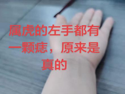 属虎的人左手都有一颗痣,原来是真的,我也有。